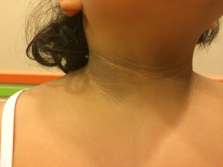 Cocuk Endokrinoloji Ve Diyabet Prof Dr Sukru Hatun Koc Universitesi Hastanesi 90 850 250 8 250 Cocuklarda Insulin Direnci Nasil Bir Sorun