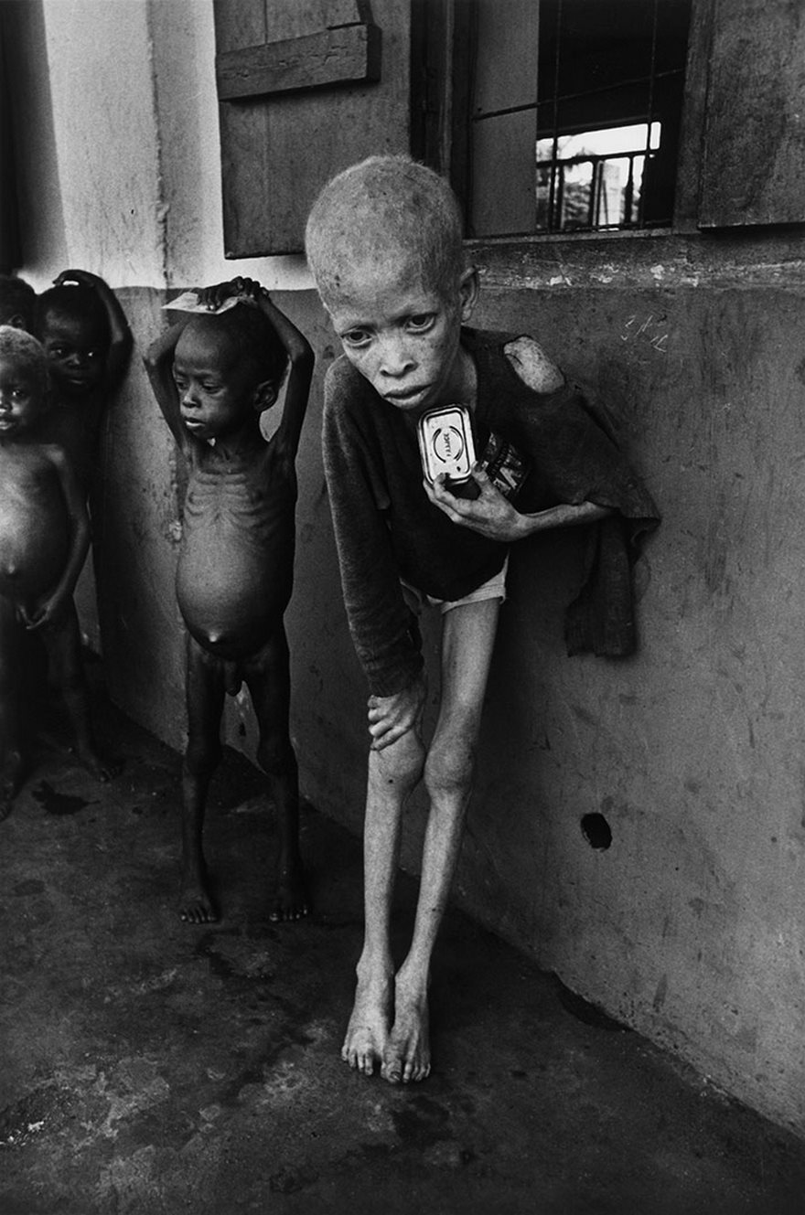 Top 100 Of The Most Influential Photos Of All Time - Albino Boy, Biafra, Don Mccullin, 1969