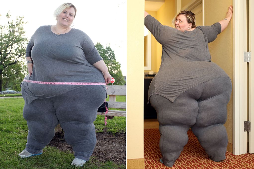 Meet The 35-Stone Woman With Eight Foot Hips Whos Making -4496