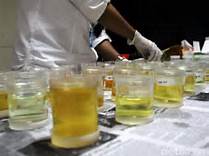 Hasil tes urine Hasil tes urine