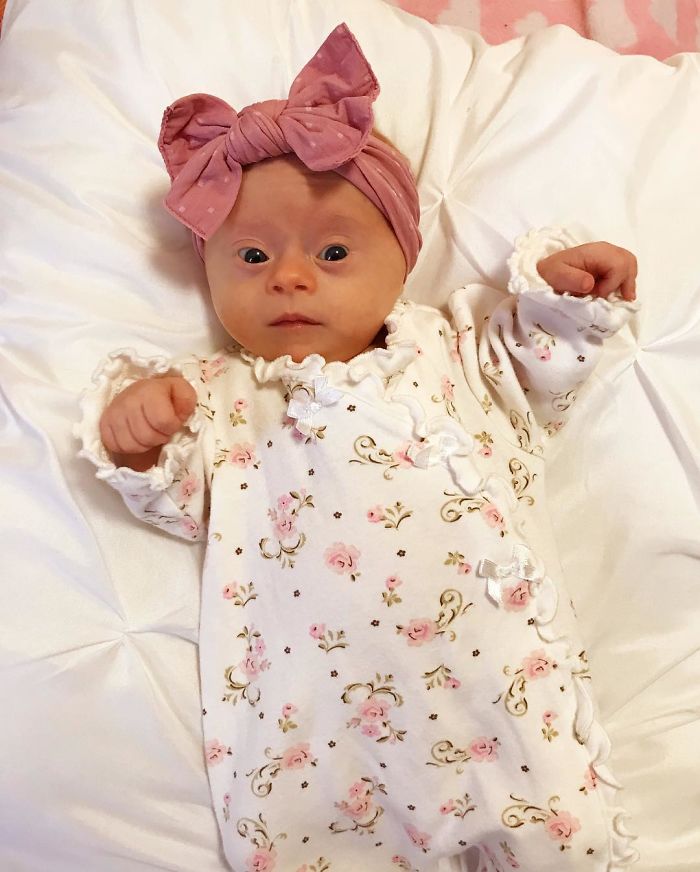 Mother Shares Powerfully Honest ‘Review’ Of Her Baby With Down Syndrome