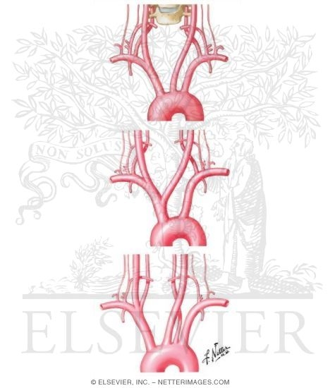 Pedi cardiology: Anomalous origin of Vertebral Artery calcium regulation diagram 
