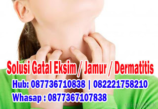 Foto Cara Alami Menyembuhkan Kulit Gatal Bersisik