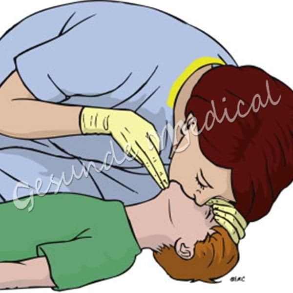 продолжительность выдоха при проведении искусственного дыхания. искусственное дыхание вдоха. сердечно-легочная реанимация рот ко рту. искусственное дыхание вдоха.