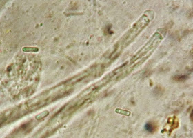 Ophiocordyceps variabilis asci and fragmented spores