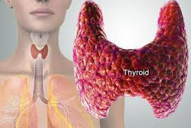 obat kelenjar tiroid herbal