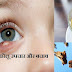 अंजनहारी (आँखों की सफ़ेद मुह वाली फुंसी) - लक्षण सावधानी और उपचार