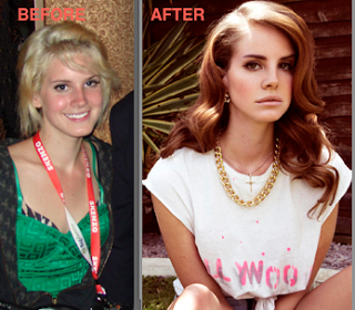 [Image: lana_del_rey_plastic-surgery-before-after.png]