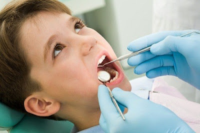 Sâu răng cho trẻ em làm thế nào để phòng ngừa?