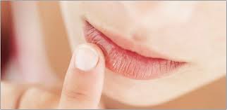 8 Cara Mengatasi Bibir Kering Pecah-pecah