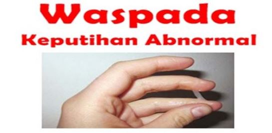 Keputihan Berwarna Coklat Tidak Berbau - Info Kesehatan