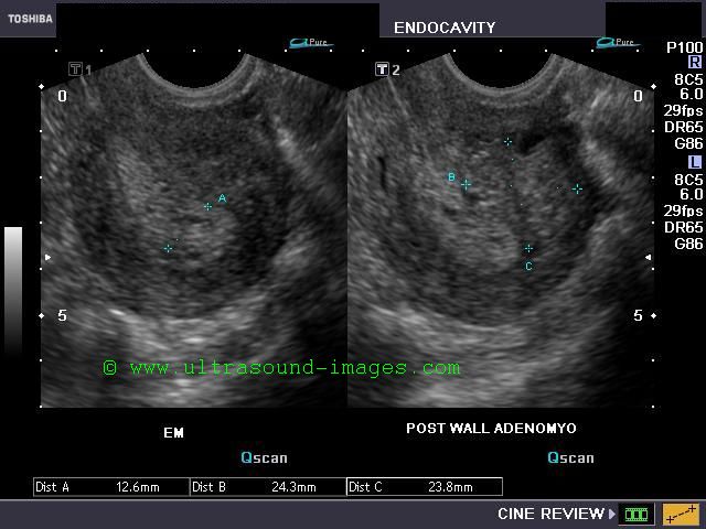 Our Journey To Bfp That Long And Gruesome Six Month Wait