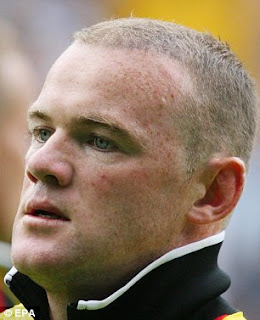 Rooney Going Grey After $30,000 Hair Transplant! 6