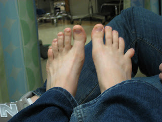 toe dislocation