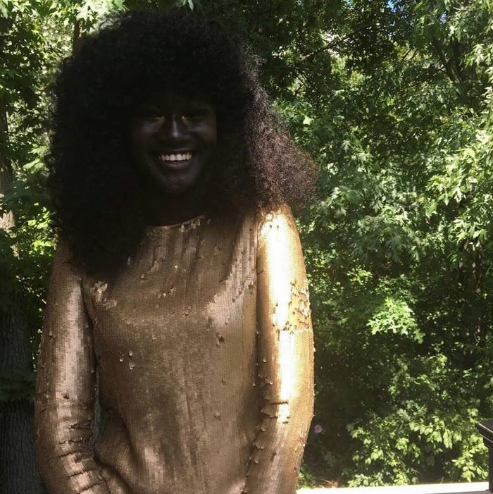 “And now even online sometimes, people will make comments” - Teen Bullied For Her Incredibly Dark Skin Color Becomes A Model, Takes The Internet By Storm “And now even online sometimes, people will make comments” - Teen Bullied For Her Incredibly Dark Skin Color Becomes A Model, Takes The Internet By Storm