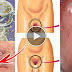 NEW SEXUALLY TRANSMITTED INFECTION HAS SPREAD… HUNDREDS OF PEOPLE COULD ALREADY BE INFECTED!