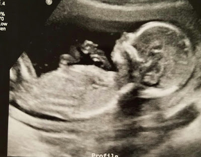 16 haftalık gebelik görüntüsü