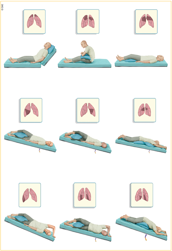 que es el drenaje postural