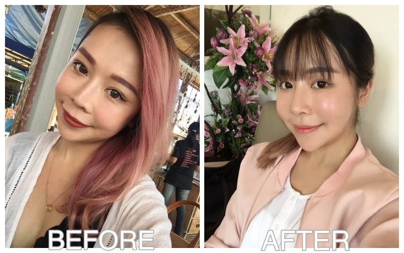 My Plastic Surgery Story In Korea Part 2 Chenelle Wen