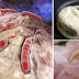 Oncologists Urge You To Stop Eating These 8 Foods That Are Proven To Cause Cancer!