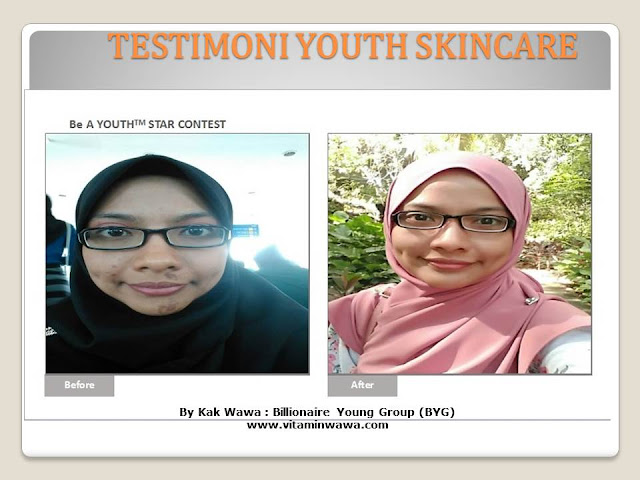 34 Testimoni Youth Skincare Shaklee Terbaru, Youth skincare shaklee, testimoni youth skincare shaklee, Youth Skincare Shaklee : Harga dan Review Pengguna Youth Shaklee, testimoni youth skincare shaklee, testimoni youth skincare shaklee 34 Testimoni Youth Skincare Shaklee Terbaru, Youth skincare shaklee, testimoni youth skincare shaklee, Youth Skincare Shaklee : Harga dan Review Pengguna Youth Shaklee, testimoni youth skincare shaklee, testimoni youth skincare shaklee