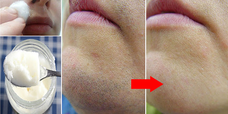 dua to remove facial hair dua to remove facial hair