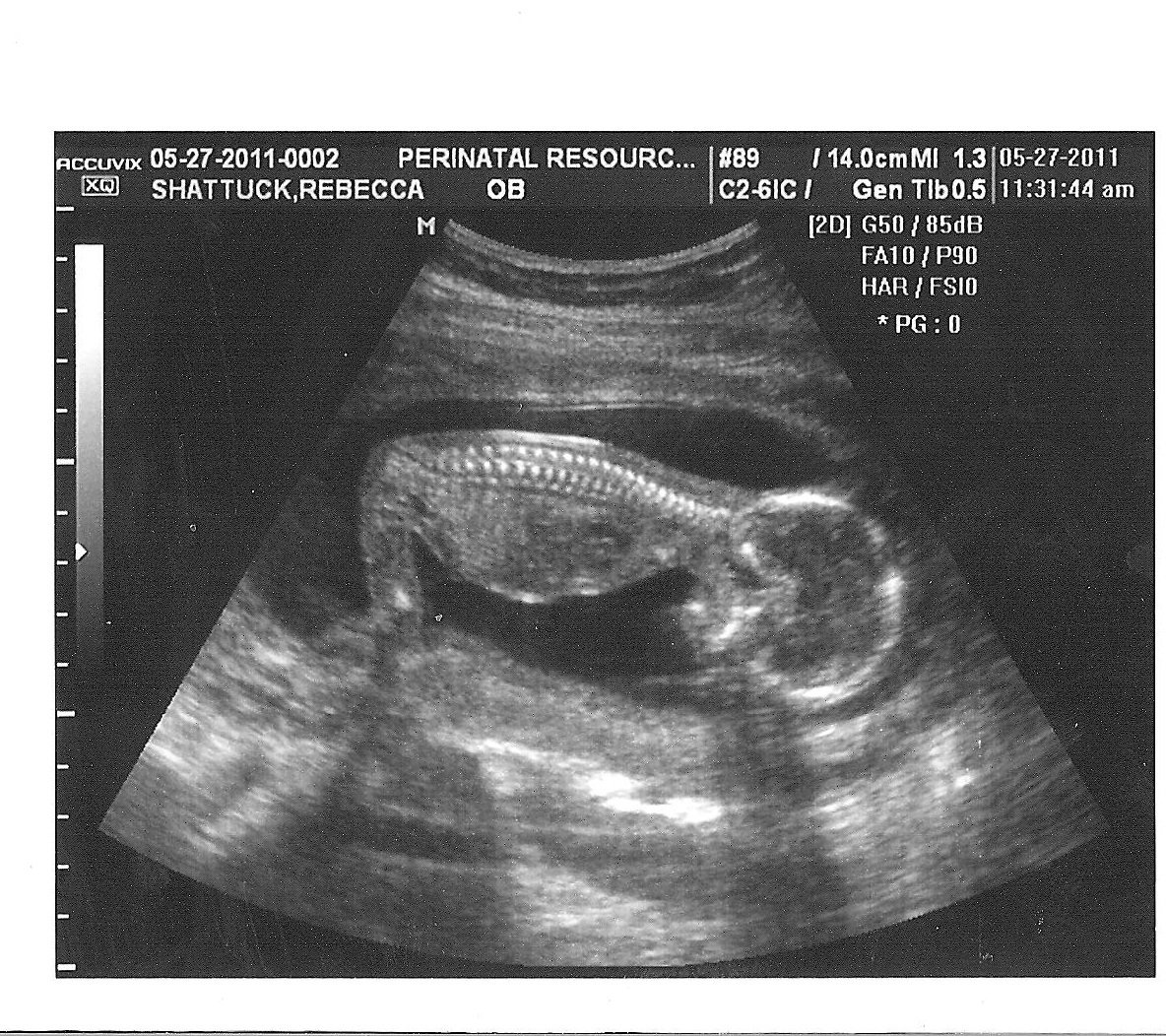 16 неделя 2023. Снимок УЗИ на 16 неделе беременности. УЗИ 16 недель пол ребенка.