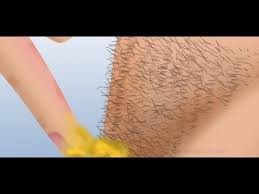 Comment se raser les parties intimes Clearance