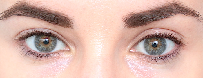 Signe Des Cils De Souque