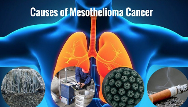 Mesothelioma Risk Faktor Mesothelioma Risk Faktor