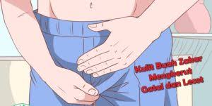 gatal pada buah zakar
