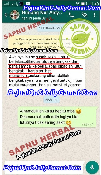 Obat TBC Tulang ( TUBERCOLOSIS TULANG ) Paling Ampuh | 100% Alami & Terbukti Manjur Obat TBC Tulang ( TUBERCOLOSIS TULANG ) Paling Ampuh | 100% Alami & Terbukti Manjur