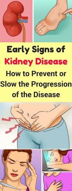 Early Signs Of Kidney, Disease-Also, How To Prevent Or Slow The Progression, Of The Disease!!!!