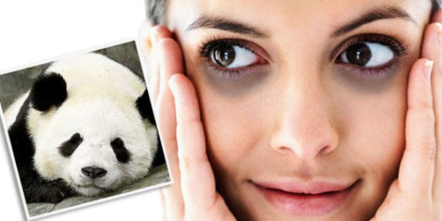 Cara cepat menghilangkan mata panda dengan alami