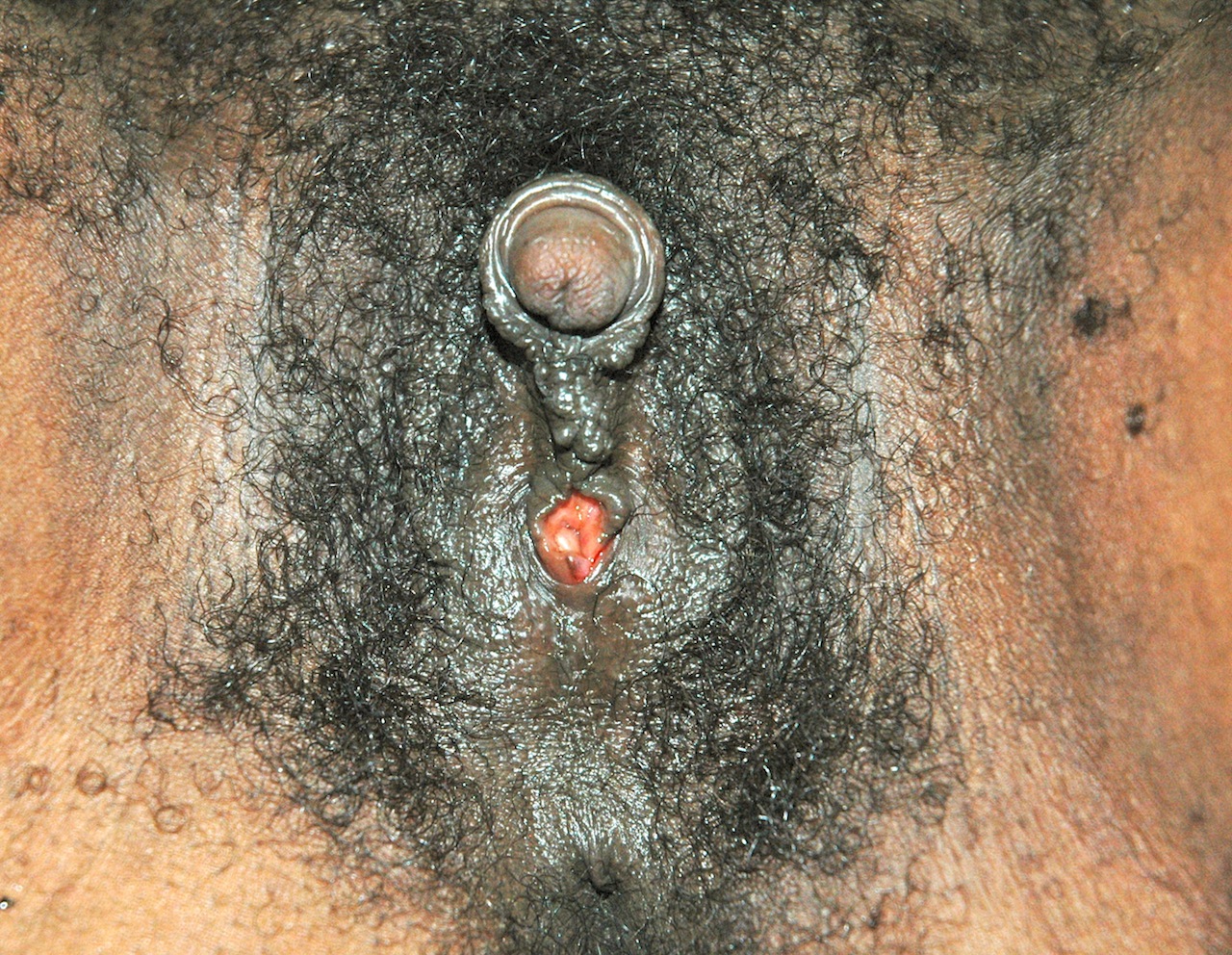 Фото Ануса Ретро. 