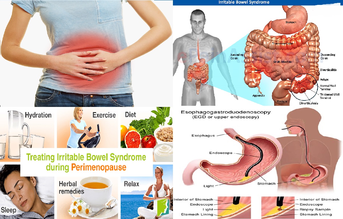 Dieta para colon irritable y gastritis