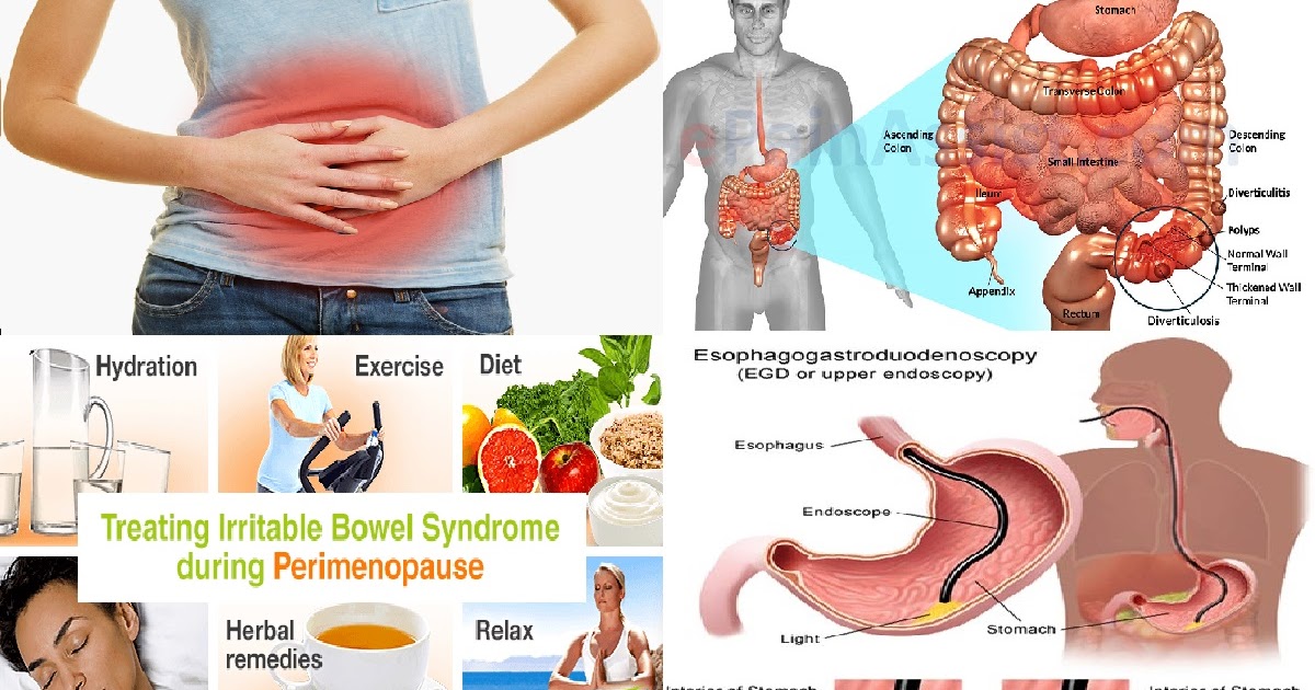 Sindrome del colon irritable dieta