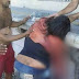 Mulher perde parte do braço ao cair de trem no Rio