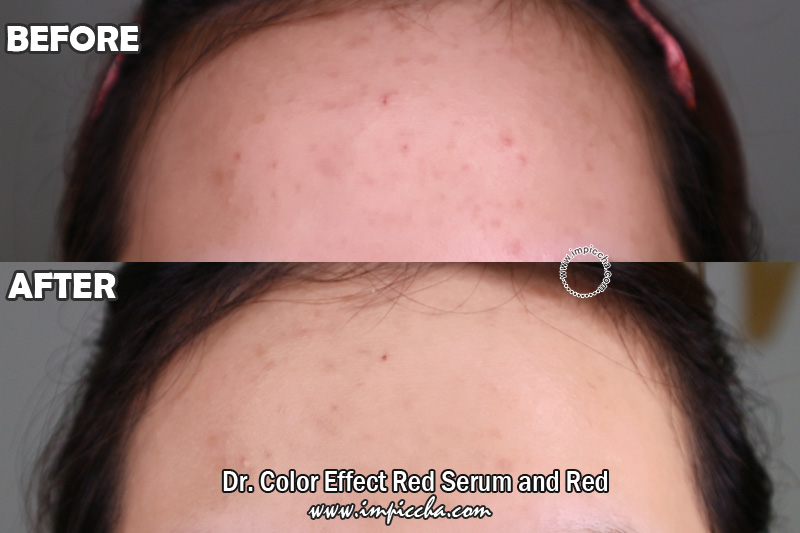 Before - After Dr. Color Effect Red Serum and Red Cream