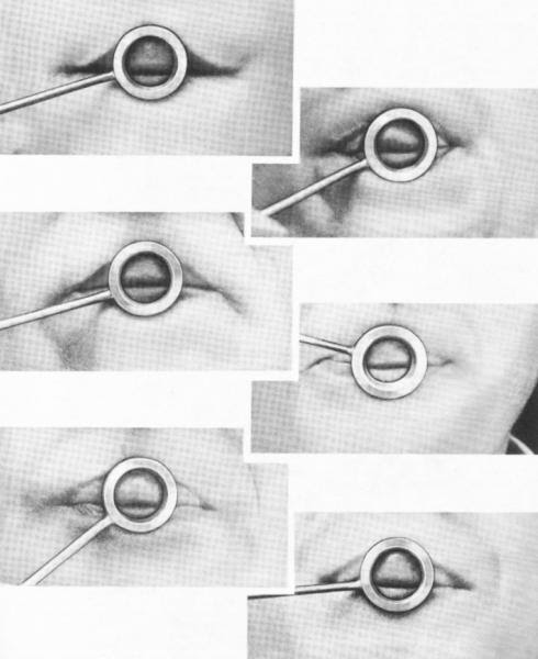 Leitão Trompete: Estudo da Embocadura.