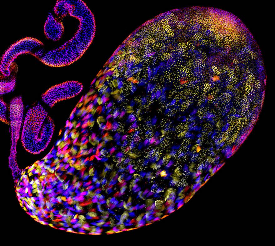 2016 Nikon Macro Photo Contest Winners Show The World Like You’ve Never Seen Before - Testis Of A Fruit Fly