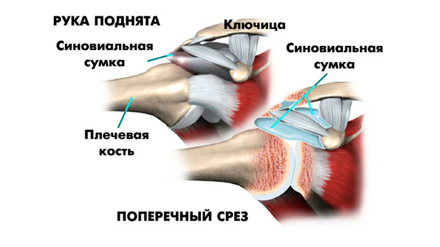 Сильная боль в плечевом суставе. Ротаторная манжета плечевого сустава анатомия. Субакромиальное пространство плечевого сустава. Плечевой сустав левой руки.