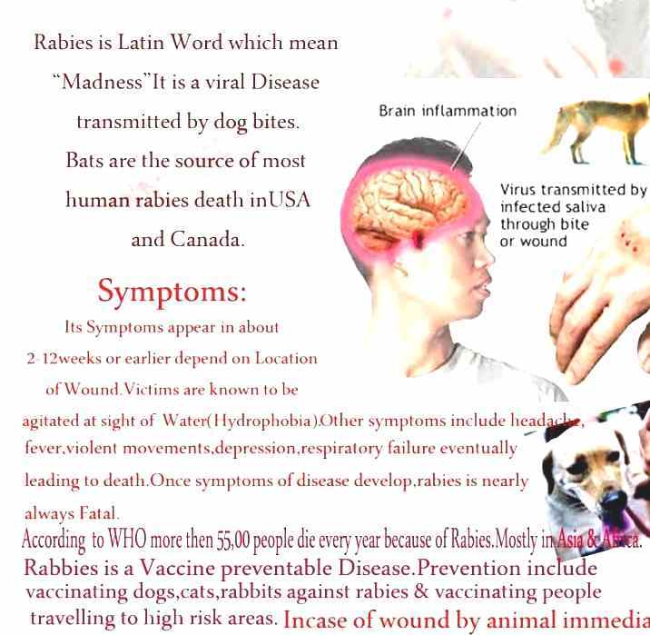 Rabies Signs Of Rabies In A Human