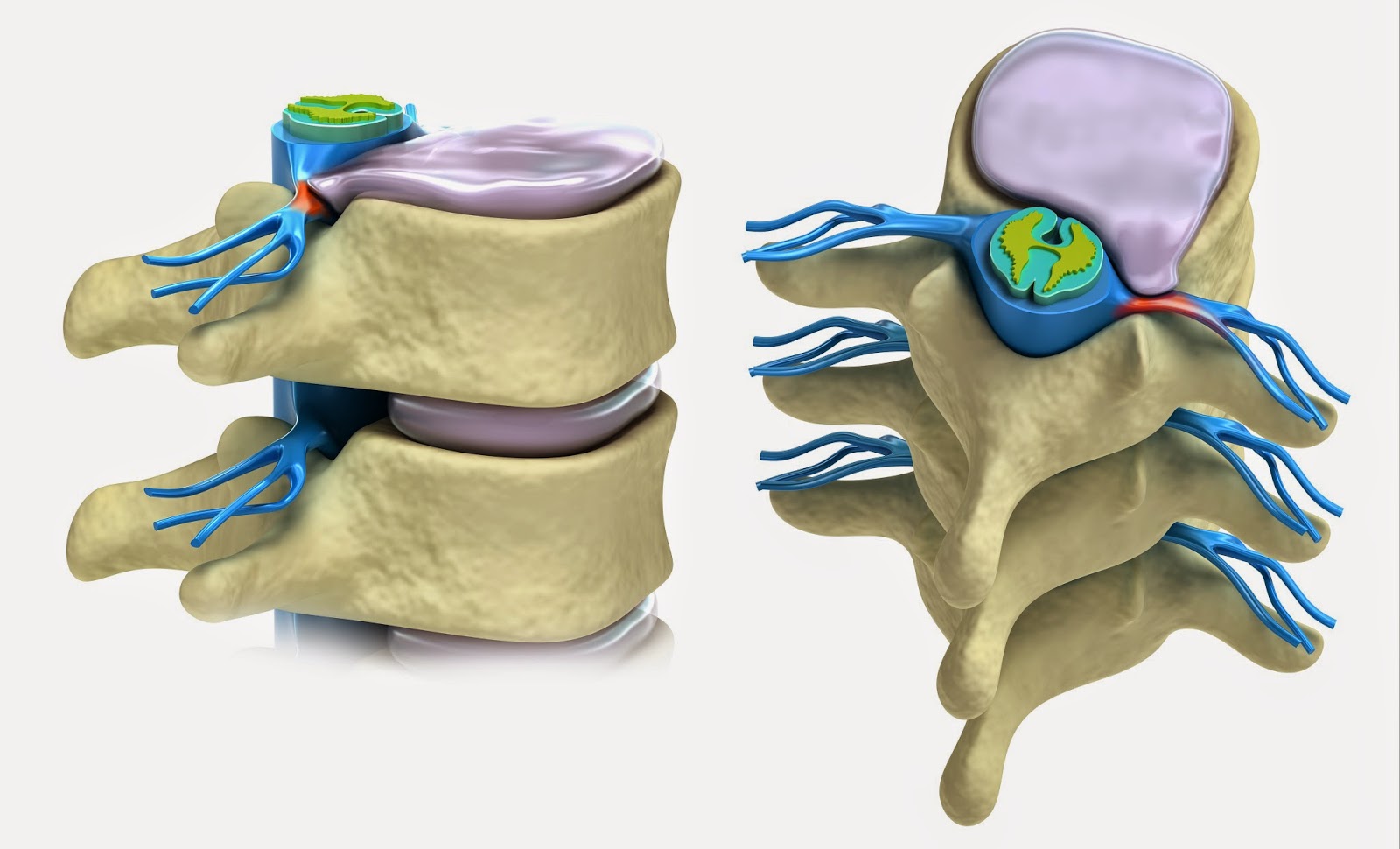 Medical Treatment Picturesfor Better Understanding Lumbar Laminectomy