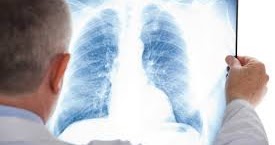Jendela Vitamin: Cara merawat jangkitan paru-paru dengan 