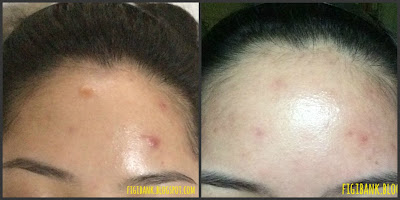 Nature Republic Real Nature Acai Berry Essence before and after