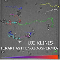 Terapi untuk Asthenozoospermia (Uji Klinis) Terapi untuk Asthenozoospermia (Uji Klinis)