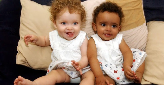 Two Twin Sisters Are Born With Different Skin Colors