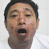 Nghệ An: Một người nhập viện sau khi ăn cá nục kho
