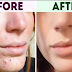 7 Easy Skincare Hacks to Make Your Skin Looks Perfect in Any Weather